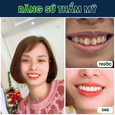 Khách hàng Nha Khoa Xuân Dũng