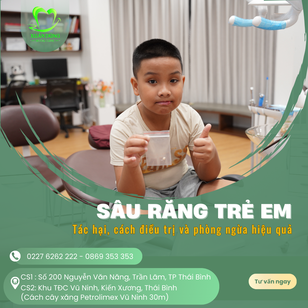 sau-rang-o-tre-em
